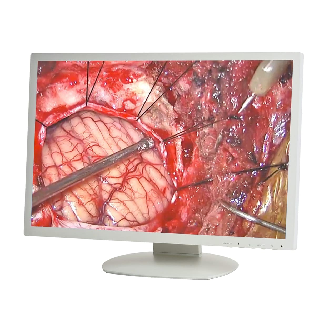 MEDICAL-GRADE LCD DISPLAYS